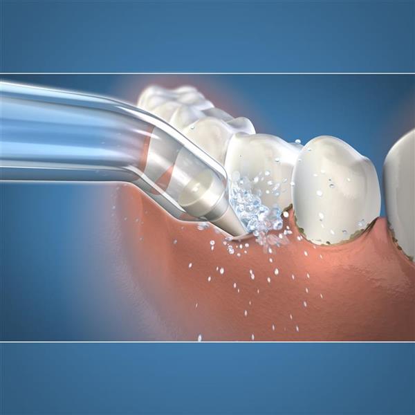 Waterpik® Pik Pocket™ Tip