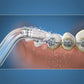 Waterpik® Orthodontic Tip
